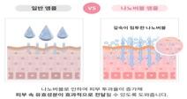 삼육대 창업보육센터 입주기업 ‘나노버블 기술’ 임상서 효능 입증