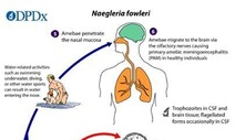 뇌조직 죽이는 아메바, 국내 첫 감염환자 사망…치명률 97%