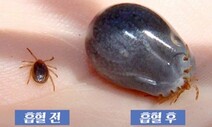 치료제 없는 참진드기 감염병…제주서 올해 첫 사망자 발생