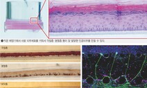 내 세포로 만든 ‘미니 장기’…아픈 피부에 희망을 꿈꾸며