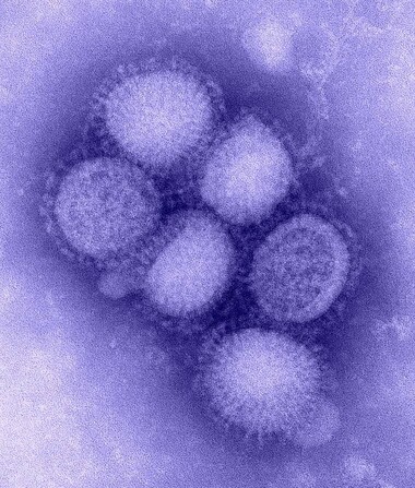 A형 인플루엔자 바이러스의 아형 H1N1의 모습. 19세기초 유럽에서 5000만명의 목숨을 앗아간 스페인 독감의 병원균이다. 위키미디어 코먼스