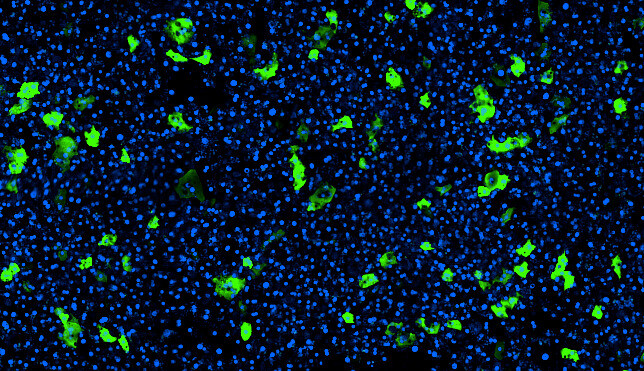 아데노연관바이러스(AAV)를 도입한 간칩(liver-chip). 에뮬레이트 제공