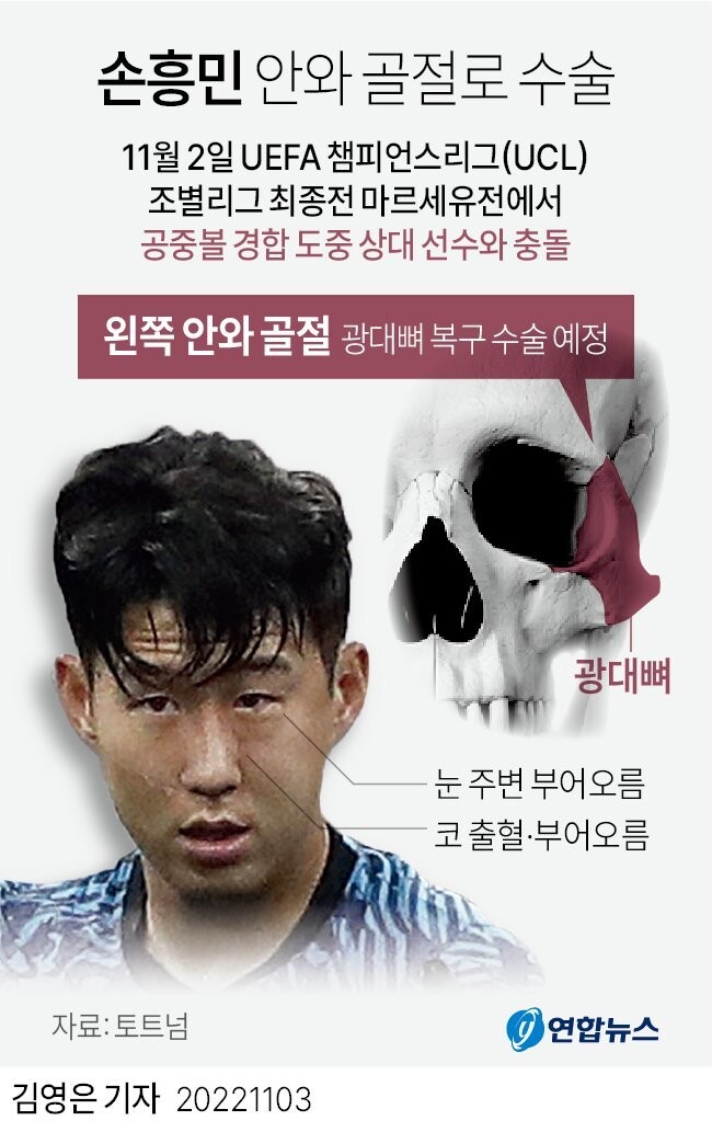 손흥민 골절 추정 부위. 연합뉴스