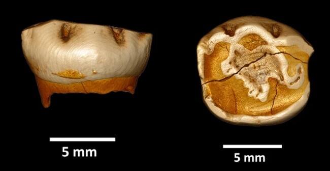 성장선이 선명하게 드러난 네안데르탈인 젖니(왼쪽)과 단면도. 볼로냐대 제공