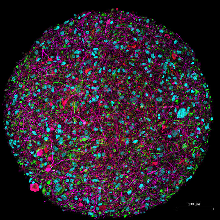 실험실에서 배양한 뇌 오가노이드의 형광 사진. 분홍색은 뉴런, 빨간색은 희돌기교세포, 녹색은 성상세포, 파란색은 모든 세포의 핵). 존스홉킨스대 제공