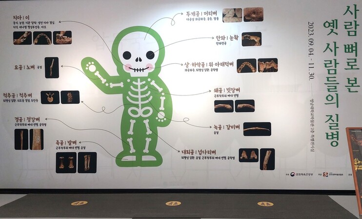 영남대 박물관의 특별전 ‘사람뼈로 본 옛 사람들의 질병’ 전시장 들머리의 설명판.