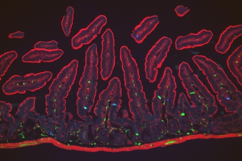 장 내부에서 활동하는 장내 크롬 친화성 세포(파란색 부분). 출처: Holly Ingraham/David Julius labs, https://www.ucsf.edu/news/2017/06/407506/rare-cells-are-window-gut-nervous-system