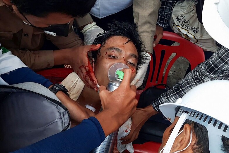 28일 미얀마 남부 도시 다웨이에서 기자들이 부상당한 남자에게 응급 조처를 하고 있다. 다웨이/AFP 연합뉴스