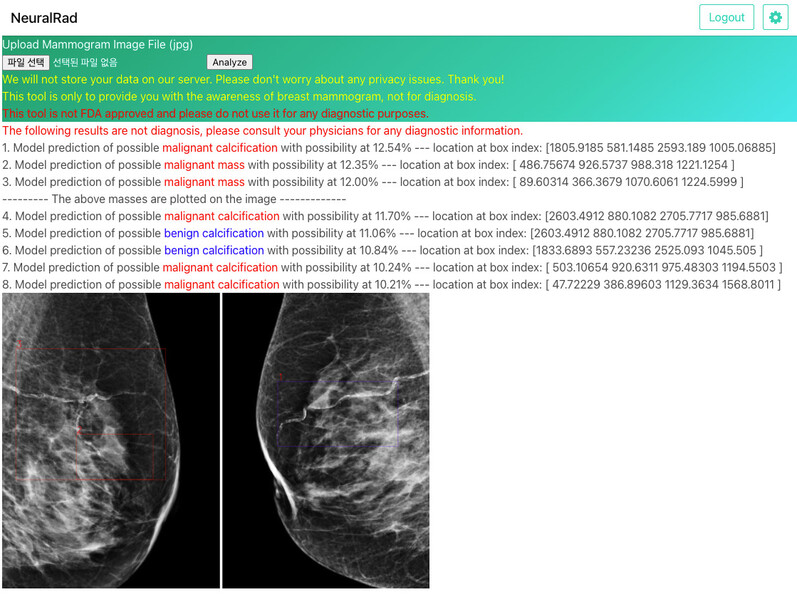 뉴럴래드에 유방 엑스(X)선 사진을 올리면 AI가 이를 판독해 유방암 발병 여부를 알려준다.
