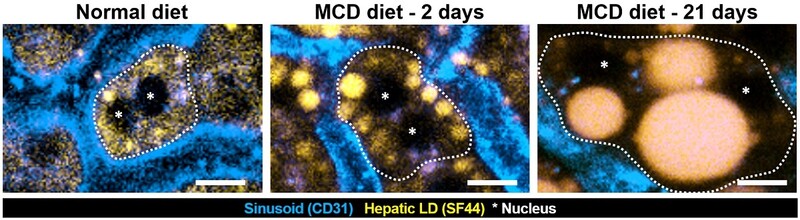 지방간을 유도하는 특수사료(MCD)를 먹인 생쥐의 간의 변화.  지방구가 커지면서 간세포 핵(*)의 위치는 물론 간세포의 모양(점선)도 변화했다.