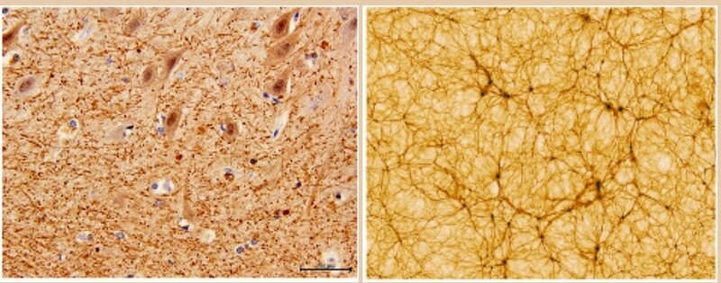 왼쪽은 전자현미경으로 본 40배율 소뇌 단면, 오른쪽은 가로·세로가 각각 3억광년인 우주 시뮬레이션 구조. 볼로냐대 제공