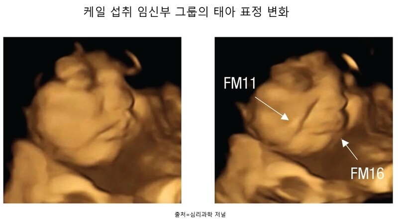 케일에 노출된 태아의 우는 표정(오른쪽)과 기본 표정. 엄마가 케일을 섭취하자 태아 얼굴에 팔자 주름(FM11)이 생기고 태아가 아랫입술(FM16)을 지긋이 눌렀다.