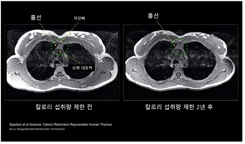 식사량을 줄이기 전(왼쪽)과 후의 흉선 비교. 식사량을 줄인 뒤 흉선이 다시 커졌다. 예일대 보도자료