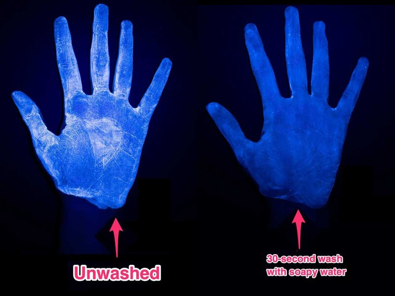 씻기 전의 손(왼쪽)과 비누와 물로 30초간 씻은 후의 손. 흰색으로 빛나는 부분이 오염물질이다. 비즈니스 인사이더에서 인용