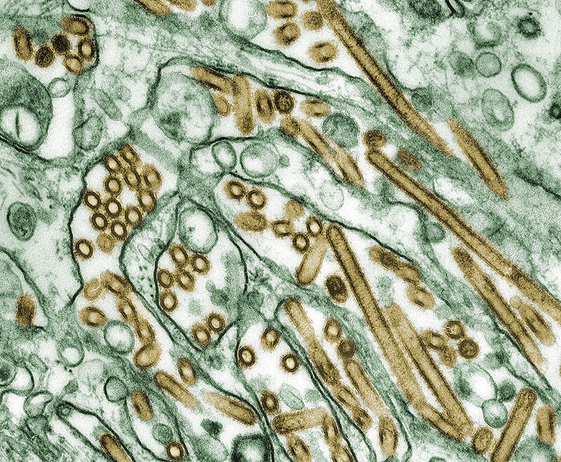 채색 투과 전자현미경으로 본 조류 인플루엔자 바이러스 H5N1(금색). 위키미디어 코먼스