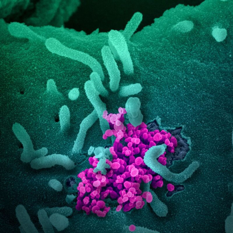 증식한 코로나19 바이러스(보라색)가 세포를 뚫고 나오고 있다. 미 국립보건연구원 제공