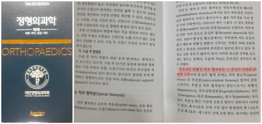 대한정형외과학회가 2020년 펴낸 &lt;정형외과학&gt; 제8판 갈무리. ㄱ씨 제공