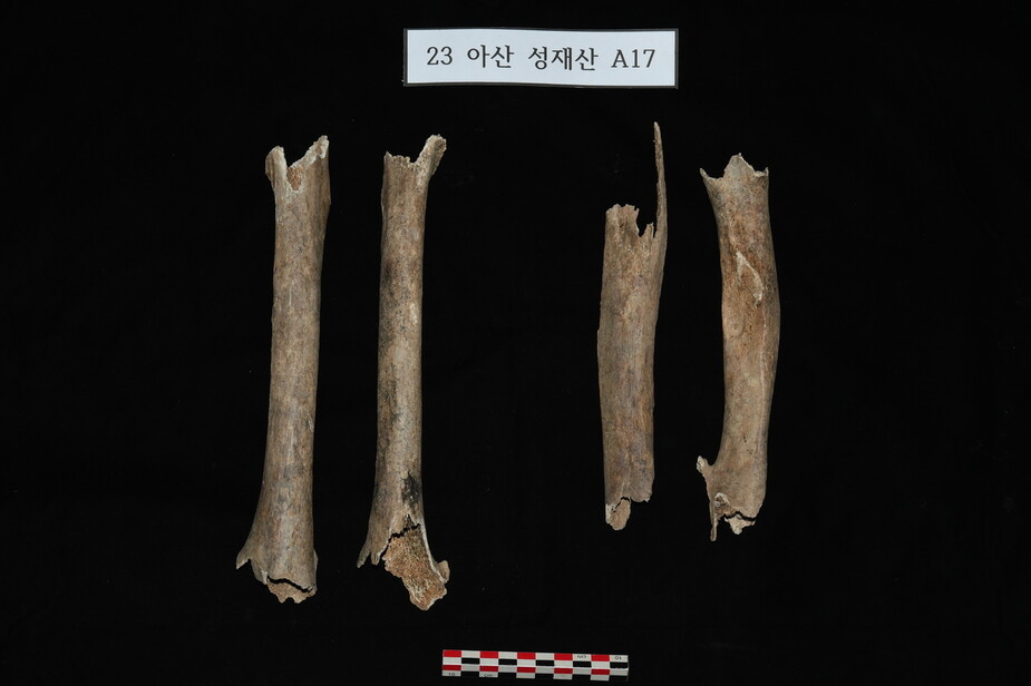 A17의 유해는 두 사람 것이었다. 오른쪽의 정강이뼈와 허벅지뼈로 추정컨대 연골형성 부전증 환자였다. 다리가 심하게 짧은 장애인이었다. 사진 진실화해위 제공