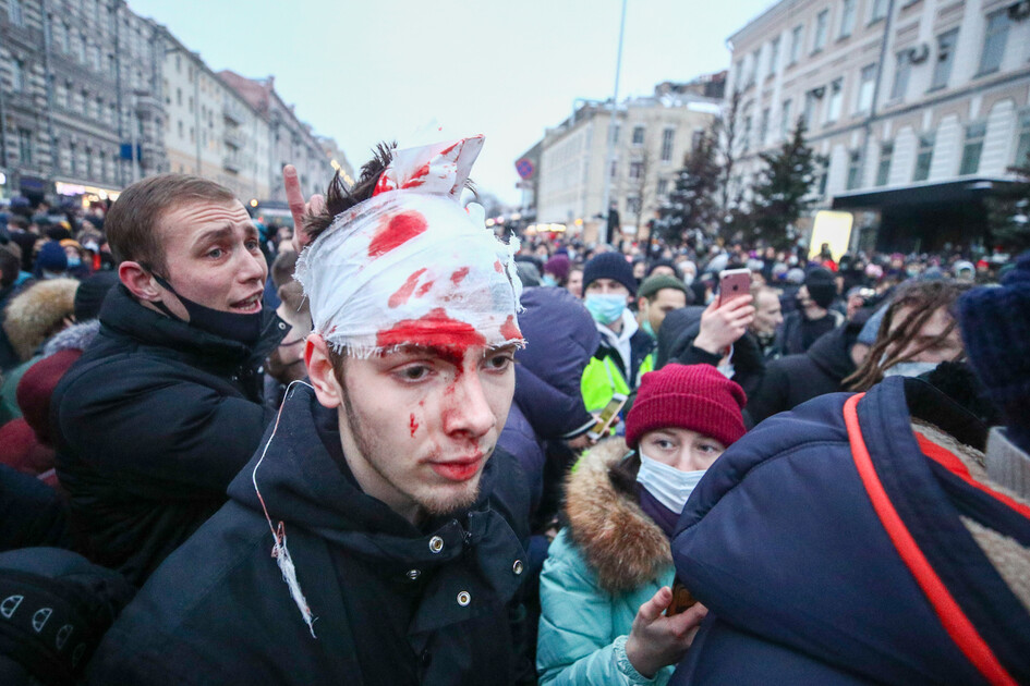 23일(현지시각) 러시아 수도 모스크바에서 열린 나발니 석방 촉구 시위에서 한 시민이 머리에 붕대를 감은 채 서 있다. 모스크바/타스 통신