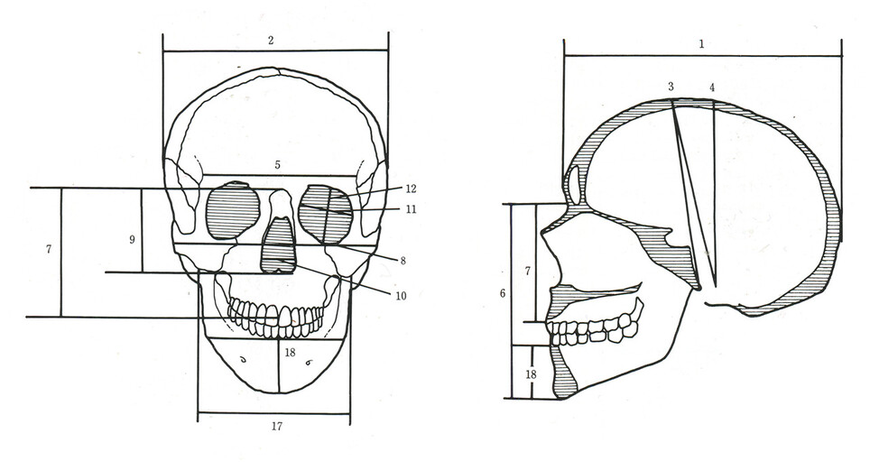 머리길이는 얼굴의 길이가 아니다. 그림 1번에 있는 눈썹 사이 가운뎃점에서 뒤통수 뒷머리점까지의 거리를 말한다. 머리 높이란 3번(전체 높이)과 4번(수직 높이)으로 귀 옆 점으로부터 머리 꼭대기에 있는 정수리점 높이까지의 거리다. 머리너비는 2번으로 각 귀 옆 점 사이의 거리를 잰 것이다. 출처 한국구석기학 연구의 길잡이(손보기 지음)