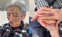 환자에 맞아 숨진 85살…“CCTV엔 요양보호사가 5분 먼저 폭행”