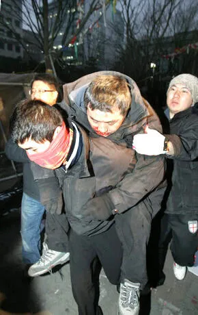  who had been sitting-in and injured amid the scuffle