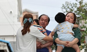 손자의 척추기형, 연결고리는 할아버지의 고엽제