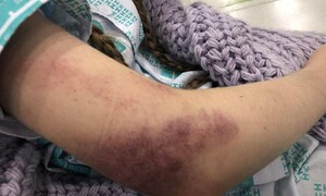 “이태원 참사를 잊지 마세요” 한국 웹툰 사랑한 외국인 생존자