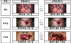 ‘흡연의 끝은 폐암’…담뱃갑 경고그림∙문구 바뀐다