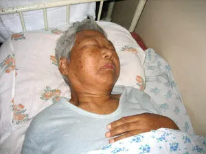  who is hospitalized in Sakhalin.