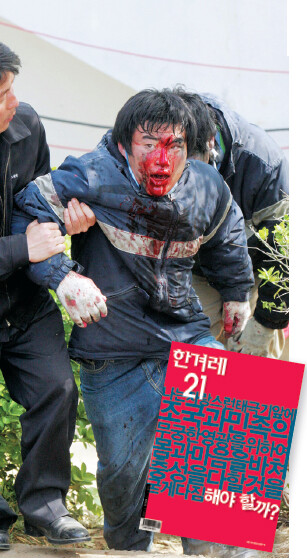 2006년 5월4일 미군기지 이전 예정지인 경기도 평택시 대추리에서 철조망 설치를 막던 한 대학생이 경찰과의 충돌로 피를 흘리고 있다.한겨레 김경호