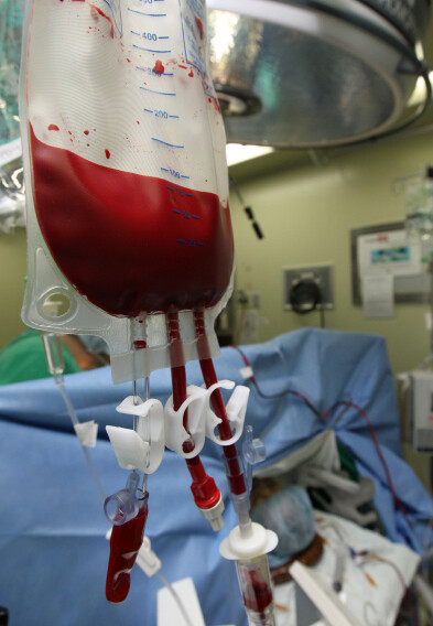 » 부천세종병원 수술실에서 무수혈 심장수술이 진행되고 있다. 사진에 보이는 혈액 주머니에는 헌혈자의 피가 아니라 수술을 받고 있는 환자의 피가 담겨 있다. 수술 중에 나온 환자의 피를 ‘셀세이버’에서 걸러내 적혈구만 따로 모은 뒤 다시 환자에게 투여한다. 한겨레21 류우종 