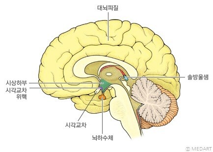 사람 뇌의 단면도. 송과선(솔방울샘)은 좌우 대뇌반구 사이 뇌실에 있다. https://www.brainmedia.co.kr/Insight/20745