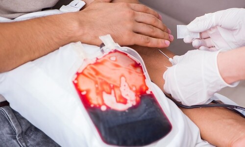 혈액형 상관없이 수혈받나…A·B형, O형으로 바꾸는 효소 발견