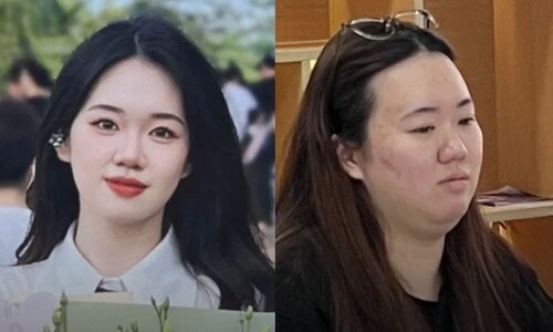 월급은 안 늘고 몸무게만…중국 직장인 ‘과로 비만’ 앓는다