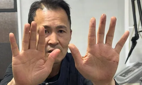 “4살 때 끌려간 보육원서 폭행”…55살 송씨가 한강대교 오른 이유