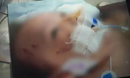 정성호 장관 “해든이 사망에 분노…아동학대 법정형 상향 검토”