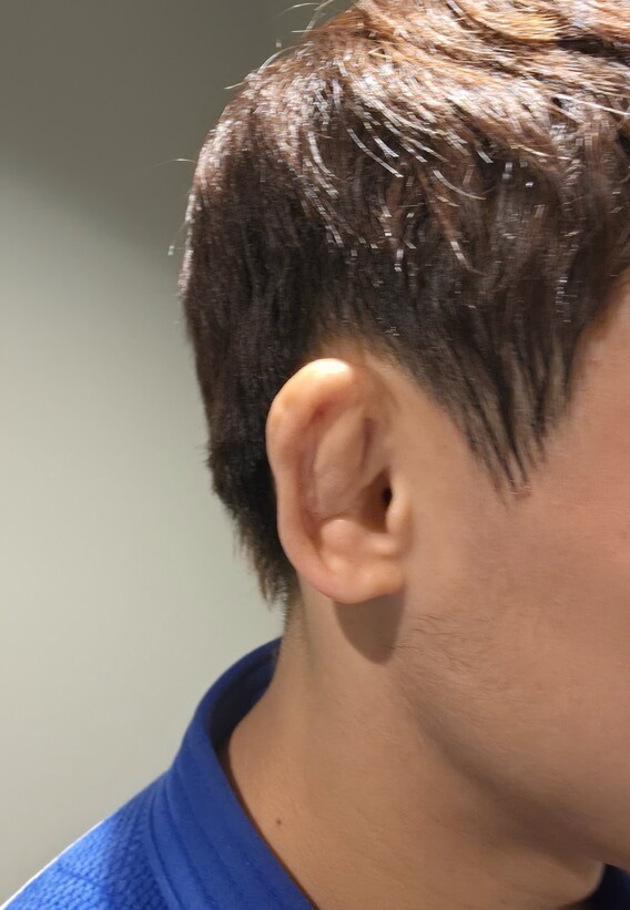 유도 김찬녕의 양쪽 귀는 매트에서 메치고 넘어지기를 반복하면서 변형됐다. 나고야/남지은 기자