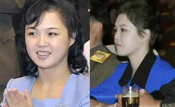 wife of North Korean leader Kim Jong-un