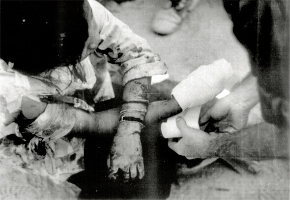 1968년 2월12일 오후, 미군 상병 본이 퐁니·퐁넛 마을에서 마지막으로 찍은 사진. 미군 병사가 16살 소녀 쩐티득의 부상당한 팔을 치료하고 있다. 이는 사건의 진상을 담은 미군 보고서에 P번 사진으로 첨부되었다. 본 상병이 찍은 사진들은 미 국립문서보관소에서 1999년 비밀 해제된 뒤 〈한겨레21〉 2000년 11월23일치(제334호) 표지이야기에 처음 공개되었다.한겨레 자료