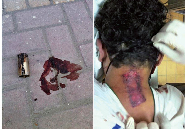 바레인워치 활동가들은 지난 3월19일 국회 토론회에서 알리 셰이크의 사진을 보여주었다. 활동가들은 이 소년이 최루탄을 목에 맞아 사망했다고 전했다.바레인워치 제공