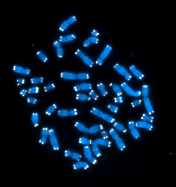 미국국립보건원(NIH) 산하 국립암연구소가 제공한 인간의 46개 염색체 모습. 파란색의 각 염색체 끝에 흰색으로 보이는 것이 텔로미어다. 상당수의 연구자는 텔로미어에 수명과 암에 관련한 비밀이 숨어 있을 것으로 본다. AP 연합뉴스
