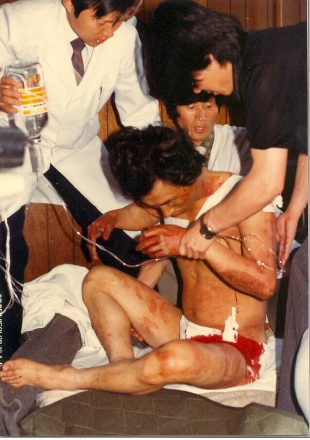 Medics tend to a wounded individual who was transferred to the Kwangju Christian Hospital during the uprising.