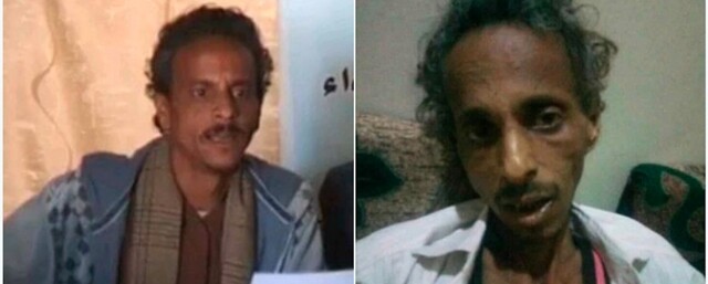 후티 반군에 납치됐다 1년 만에 풀려났지만 지난 6월2일 목숨을 잃은 예멘 언론인 라칸. 오른쪽은 석방된 뒤 숨을 거두기 직전 모습. 국경없는기자회 누리집