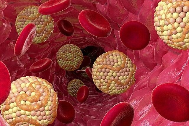혈관 내의 콜레스테롤(주황색)과 적혈구(빨간색). 위키미디어 코먼스