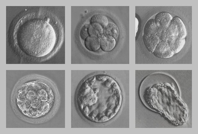 인간 배아: 인간 수정란이 ‘난할’이라는 독특한 과정을 거쳐 배아로 발달해가는 모습. 한겨레 자료