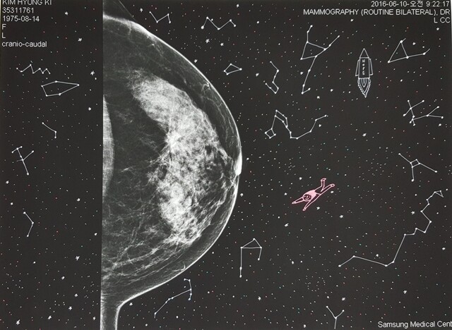 유방암 경험자 김형기씨 자신의 맘모그라피를 이용한 작품. 쏘아올린 로켓에 ‘희망’이라고 적혀 있다. 코스모스_1, mixed media on Mamography,  50.0cm x 36.0cm, 2017. 김형기 제공