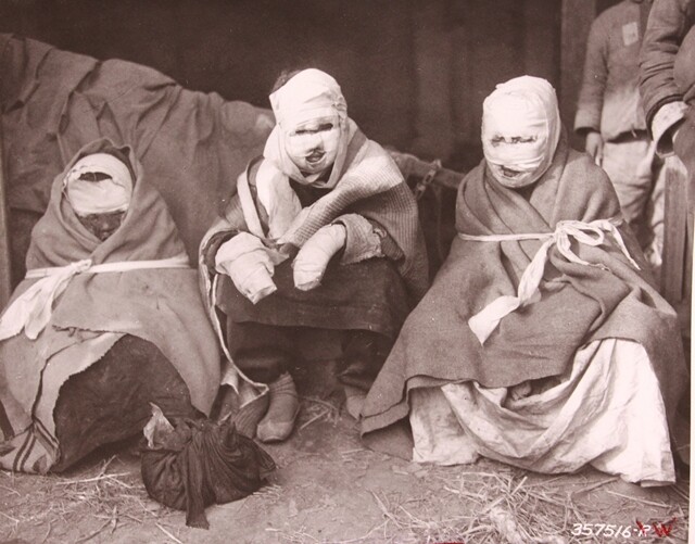 ❸ 1951년 3월6일, 네이팜탄으로 극심한 화상을 입은 여성 3명이 경기도 수원 근처 구호소에 모여 있다. 화염과 추위로 시커멓게 변한 얼굴과 손이 붕대 사이로 보인다. 미국 National Archives Ⅱ 소장(RG 111SC, 357516-W). 국사편찬위원회 제공