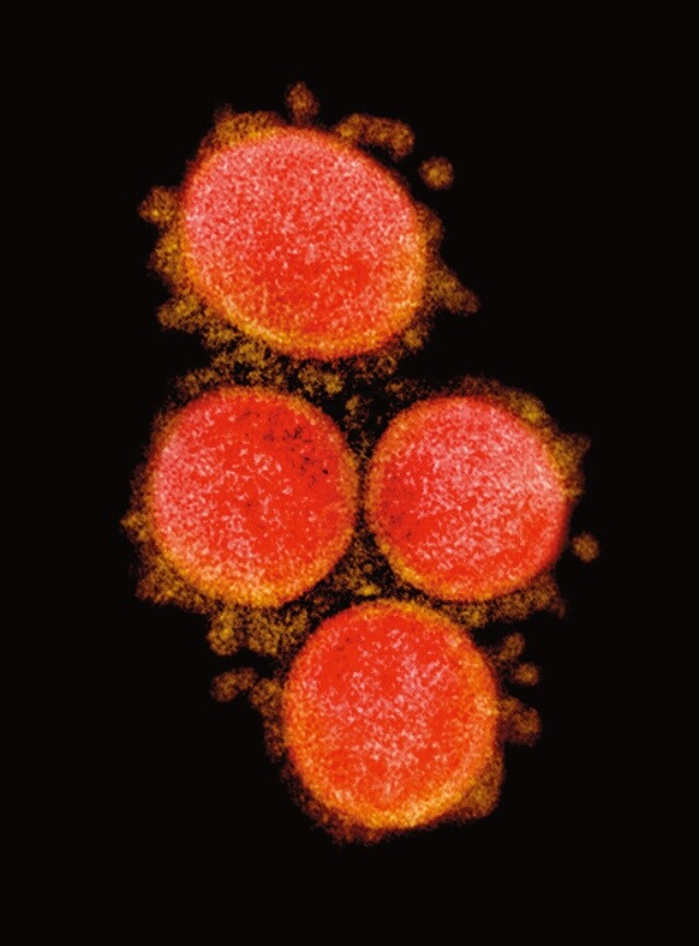 코로나19 바이러스로 알려진 SARS-CoV-2의 전자현미경 사진. NIAID통합연구시설(IRF)/로이터