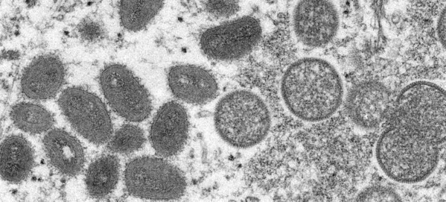 Monkeypox virions as seen through an electron microscope. (Cynthia S. Goldsmith/CDC)